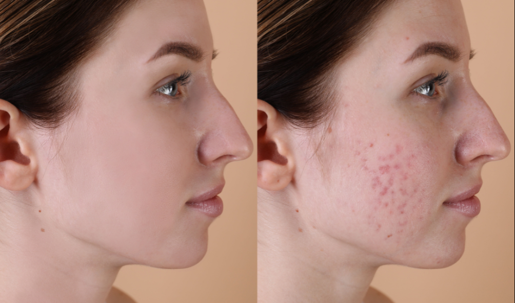 Quando consultar com um dermatologista?